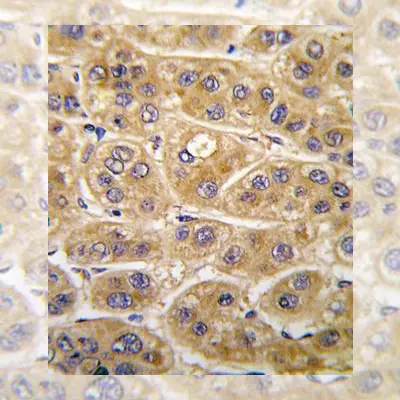 Signaling Pathways