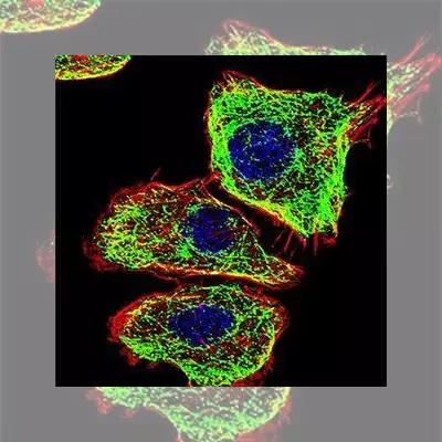 Stem Cells