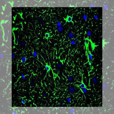 Neuroscience