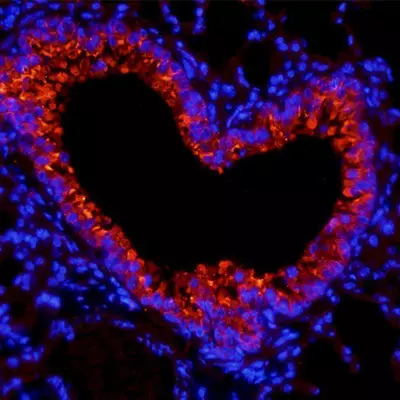 IF Staining Tips
                                                                                                                                                                                                                
                                                                                                                                                                                            
                                                                                                                                                                        
                                                                                                                                                    
                                                                                                                            
                                                                                                        
                                                                                    
                                                                
                                            </h3>
                                                                                                                                                                