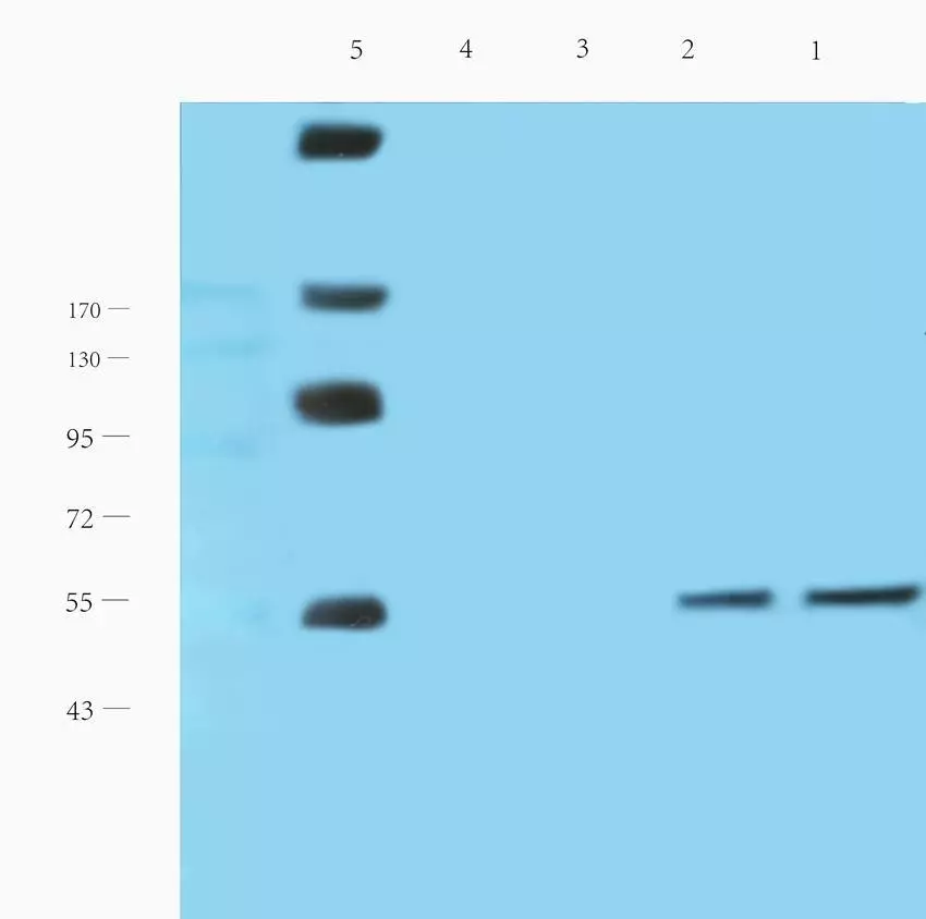 WB CD19