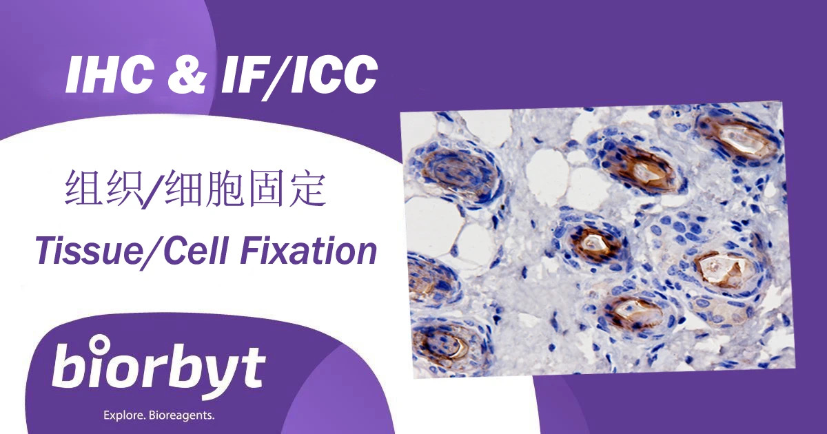 免疫组化IHC和免疫荧光IF实验固定剂选择示意