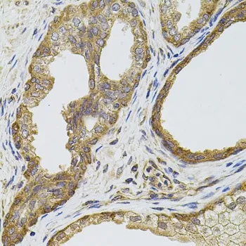 免疫组织化学(IHC)和免疫细胞化学 (ICC)在癌症研究中的应用2