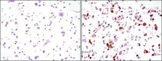 Immunocytochemistry analysis of HCC827 cells using GFP antibody