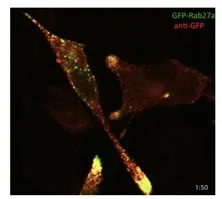 AtT-20 transfected with GFP-Rab27a and immunostained with GFP antibody