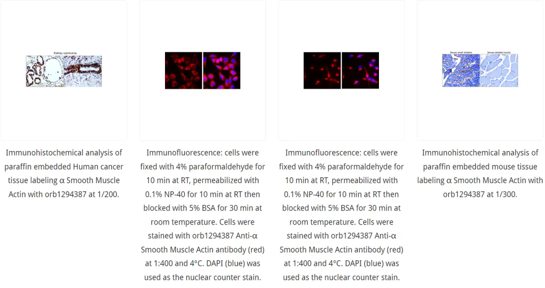 α-Smooth Muscle Actin抗体检测示例