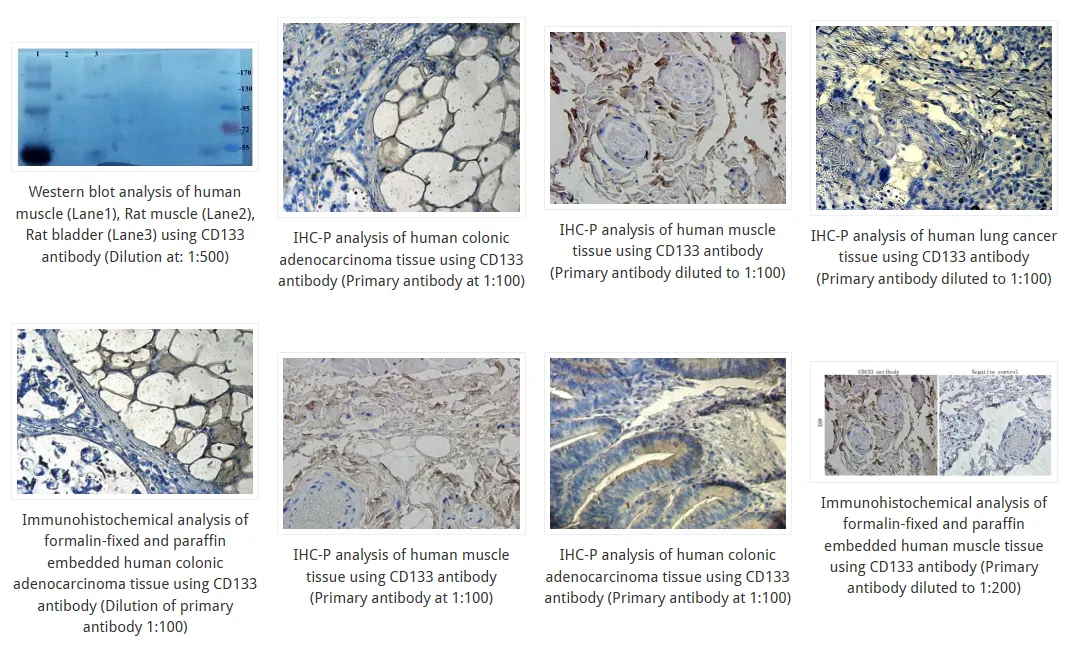 CD133 antibody IHC staining validation