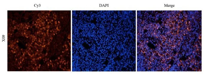 白细胞分化抗原CD分子系列10