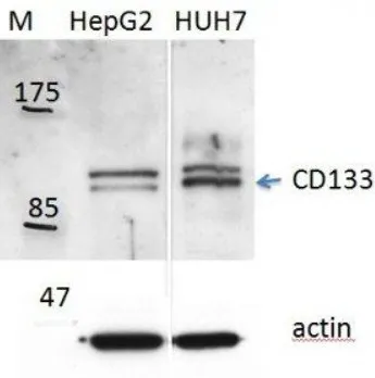 白细胞分化抗原CD分子系列17
