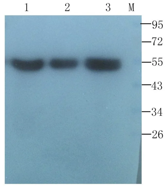 白细胞分化抗原CD分子系列5