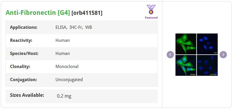 纤连蛋白Fibronectin:细胞外基质的“多维”调控者5