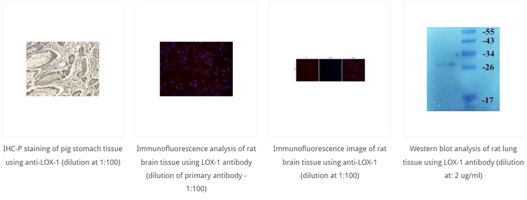 脂蛋白7