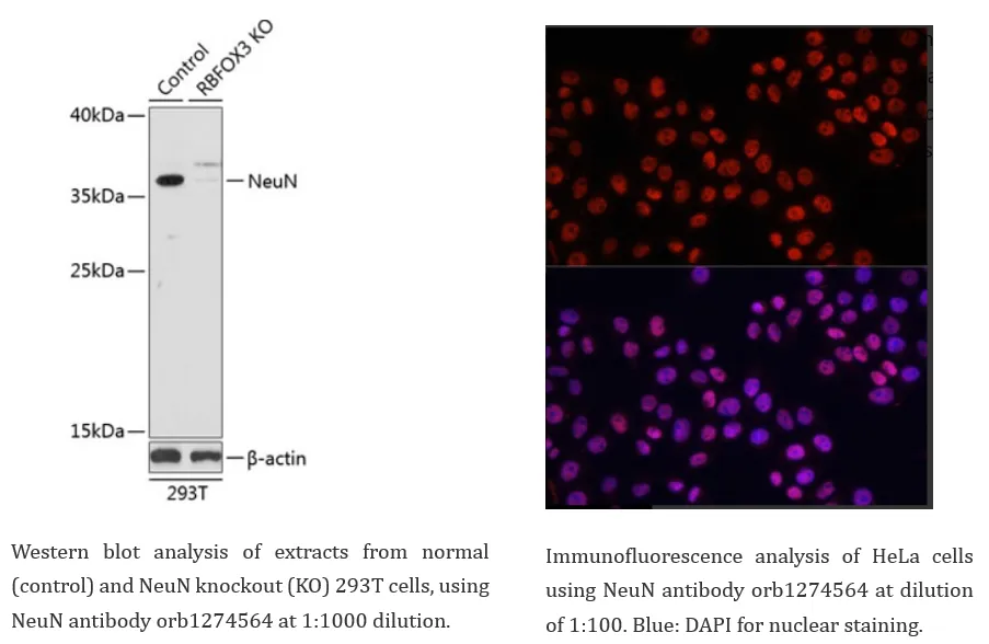 Neuroscience Cell Marker 6