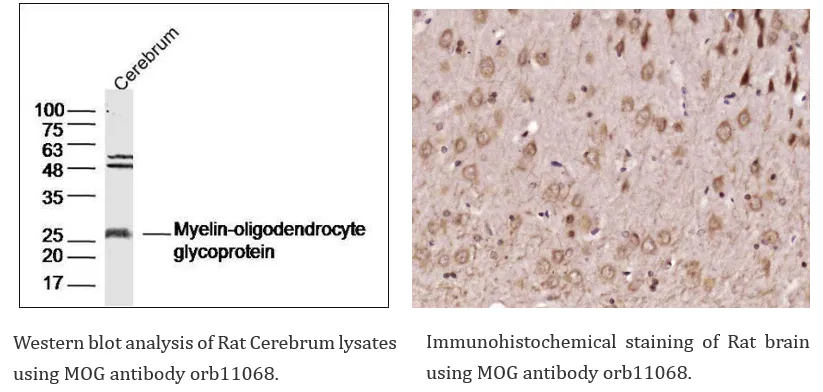 Neuroscience Cell Marker 11