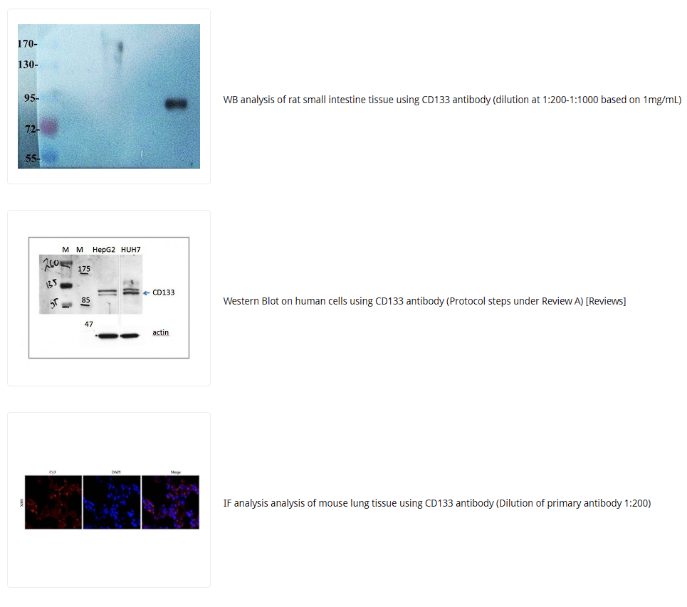 CD133抗体 Biorbyt明星抗体又收录一篇文献,是关于母乳的研究4-2