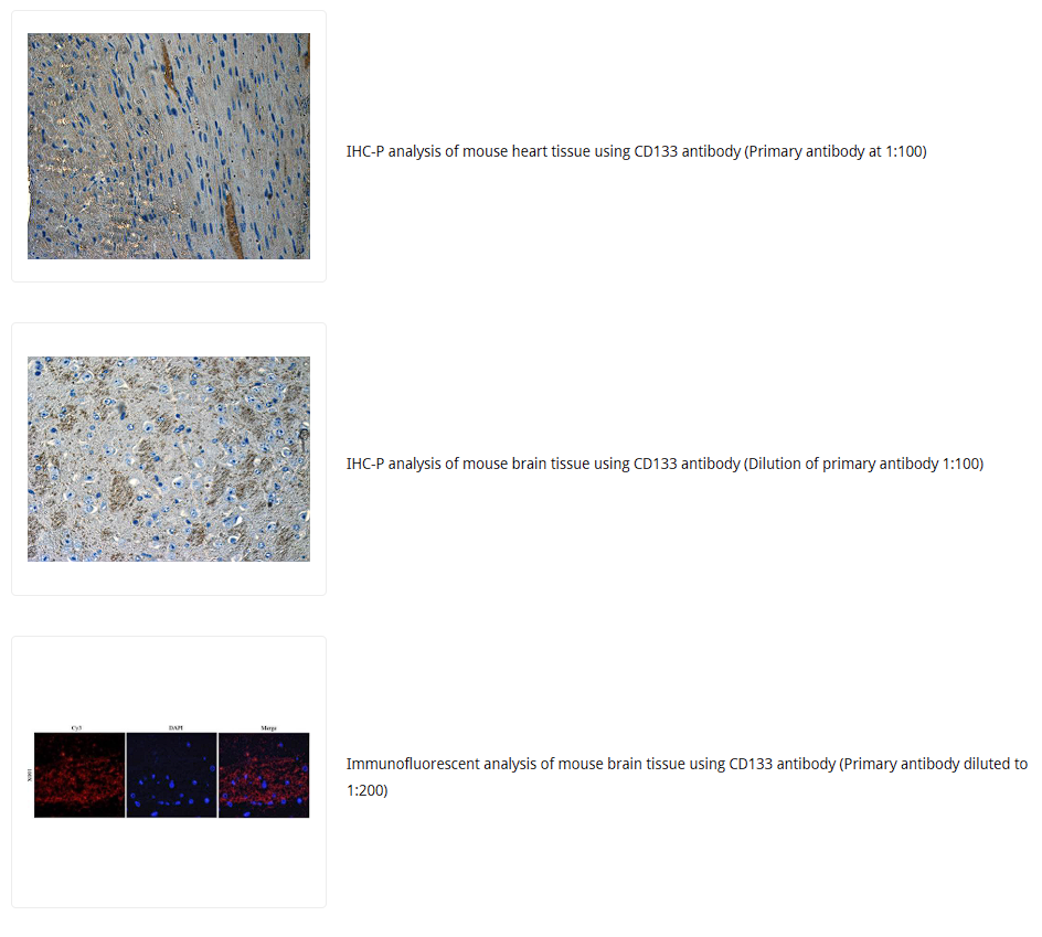 CD133抗体 Biorbyt明星抗体又收录一篇文献,是关于母乳的研究4-4