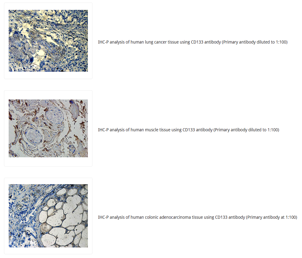 CD133抗体 Biorbyt明星抗体又收录一篇文献,是关于母乳的研究4-7