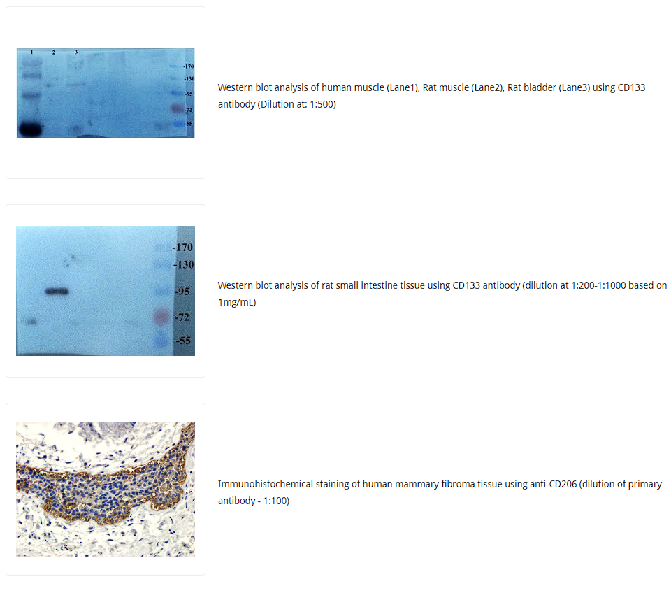 CD133抗体 Biorbyt明星抗体又收录一篇文献,是关于母乳的研究4-8