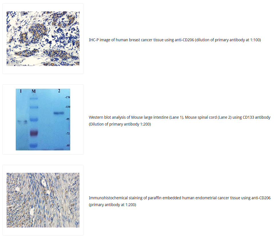 CD133抗体 Biorbyt明星抗体又收录一篇文献,是关于母乳的研究4-9
