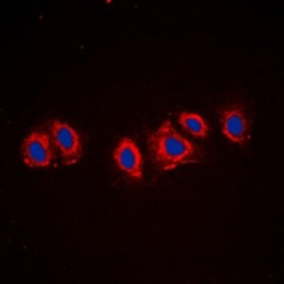 Platelet derived growth factor receptor-alpha (PDGFRA)