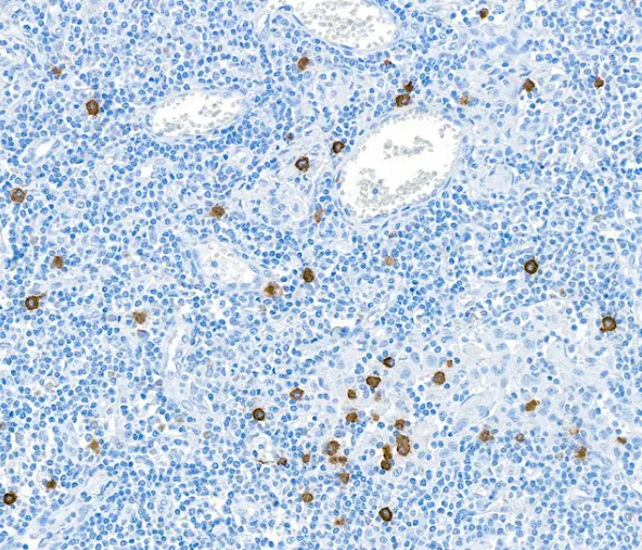 Rabbit anti-Granzyme B Antibody