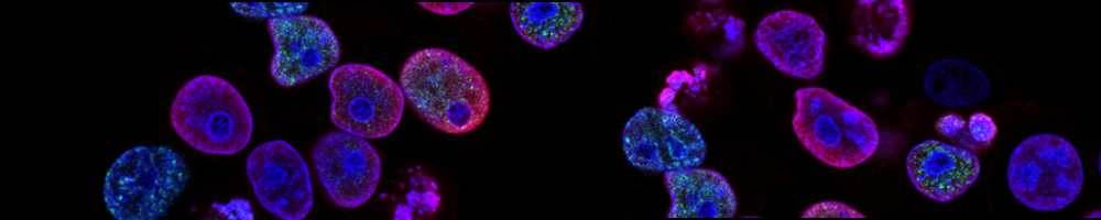 Spatial Biology Tissue Microenvironment