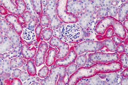 CD147 antibody