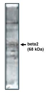 Rabbit Human Calcium Channel Antibody