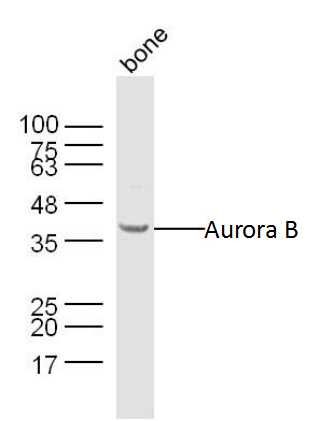Aurora B Rabbit Polyclonal Antibody (FITC)