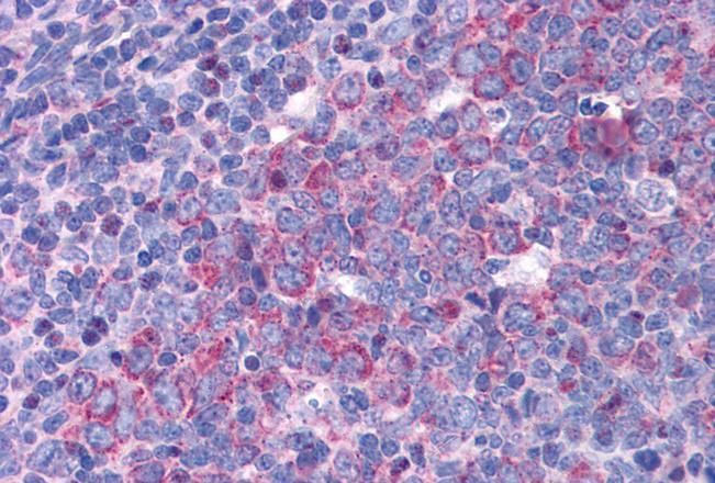 Goat anti-eIF5A Antibody