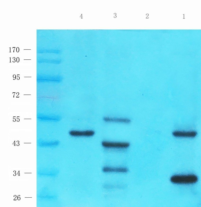P2Y2 Rabbit Polyclonal Antibody
