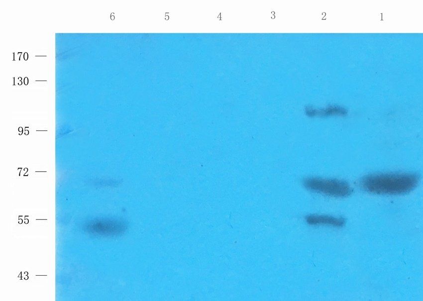 TFCP2 Rabbit Polyclonal Antibody