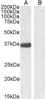 PTF1A/PFT1-P48 Antibody