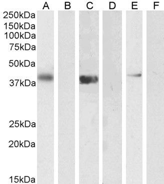 PTF1A/PFT1-P48 Antibody