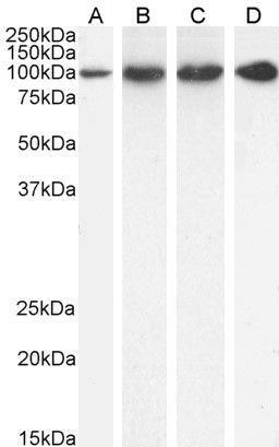 TRAP2/Proteasome subunit 26S Antibody