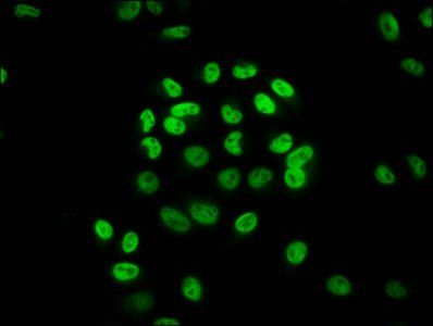 2-hydroxyisobutyryl-HIST1H3A (K36) Antibody