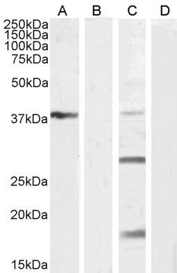 VEGFA (aa387-399) Antibody