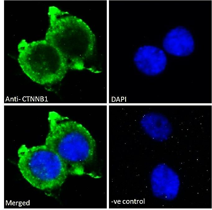 CTNNB1/catenin beta-1 Antibody