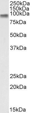 CTNNB1/catenin beta-1 Antibody