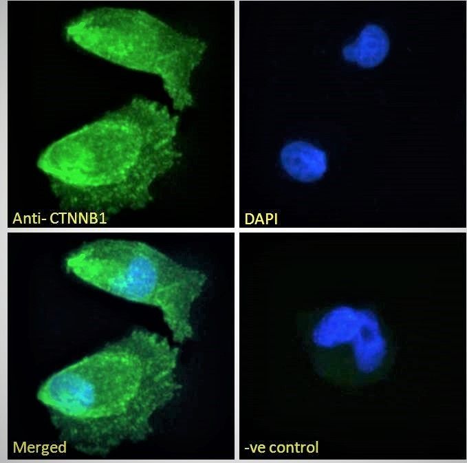 CTNNB1/catenin beta-1 Antibody