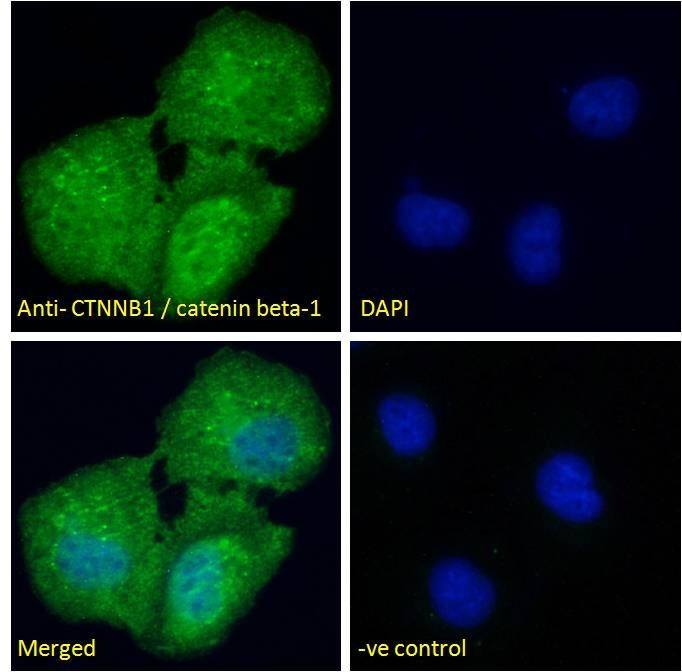 CTNNB1/catenin beta-1 (aa108-121) Antibody