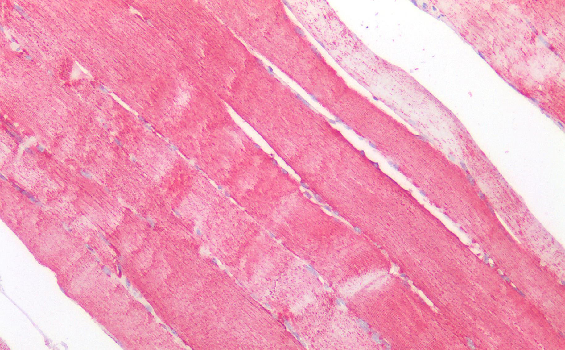 MNSOD (aa119-130) Antibody