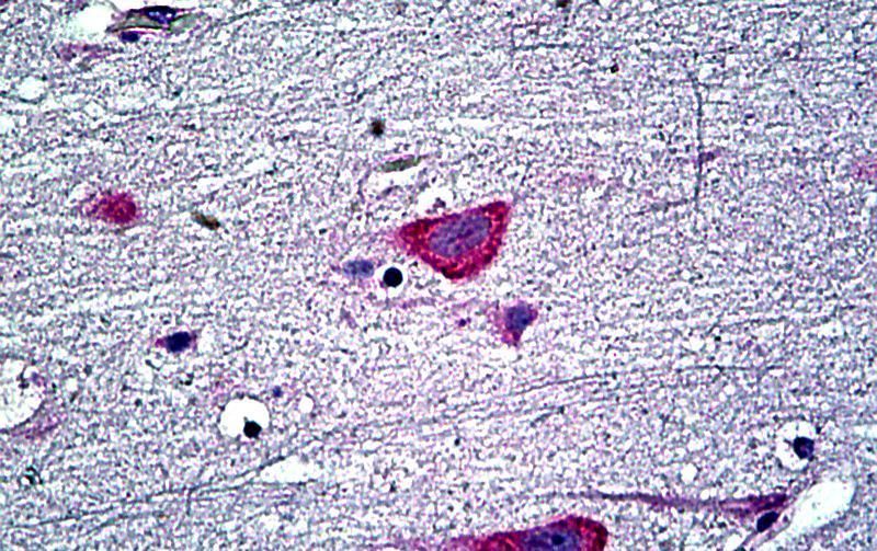 EDF1/MBF1 Antibody