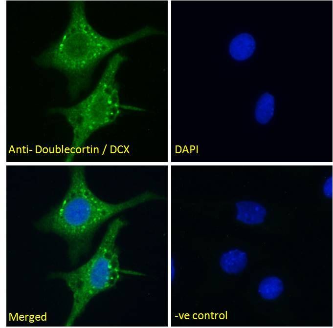 Doublecortin/DCX (aa69-81) Antibody