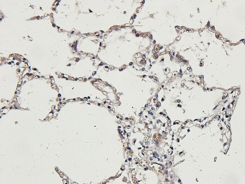 P2Y2 Rabbit Polyclonal Antibody