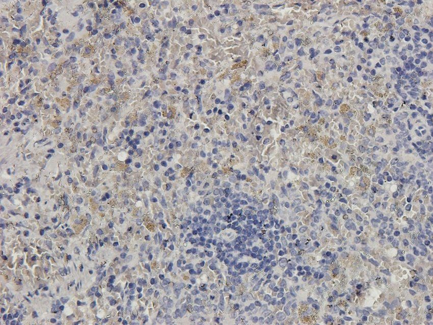P2Y2 Rabbit Polyclonal Antibody