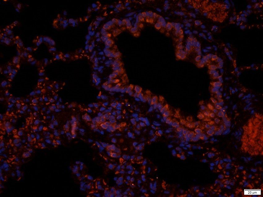 P2Y2 Rabbit Polyclonal Antibody