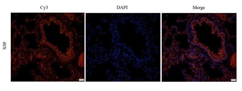 P2Y2 Rabbit Polyclonal Antibody