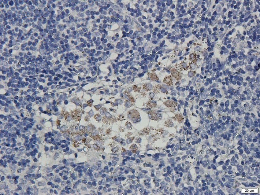 PMEL Rabbit Polyclonal Antibody