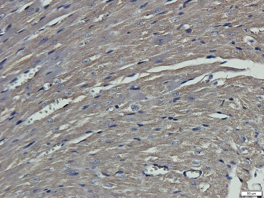 TFCP2 Rabbit Polyclonal Antibody